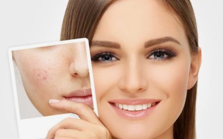 Effective Tips for Managing and Preventing Breakouts and Blemishes