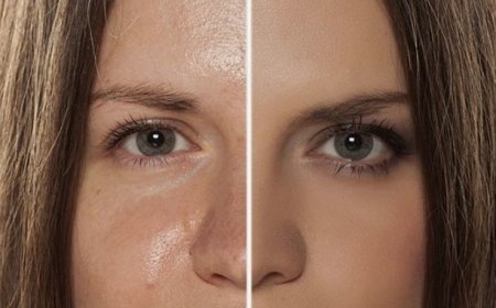 Effective Skincare Routine for Oily Skin: Controlling Excess Oil and Minimizing Shine