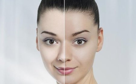 Title: Home Remedies for Skin Brightening: Tips and Cautionary Advice