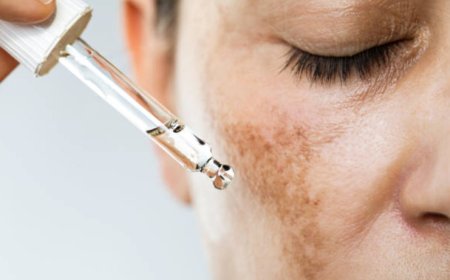 Ayurvedic Tips for Promoting Balanced Skin Health