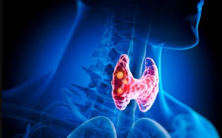 Optimizing Thyroid Health: Home Remedies and Lifestyle Tips