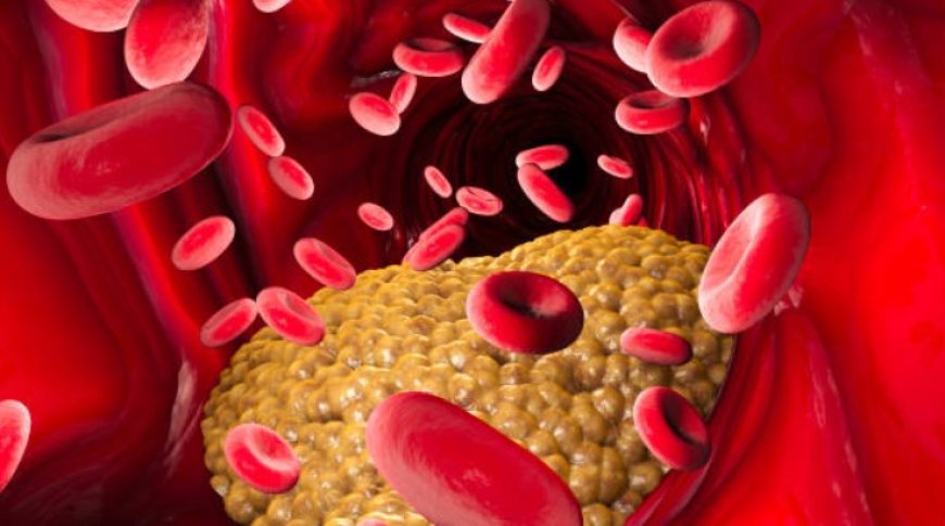 How to manage your cholesterol levels: A comprehensive guide